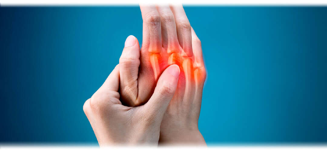 A close up of a hand with a digital overlay looking at inflamed joints