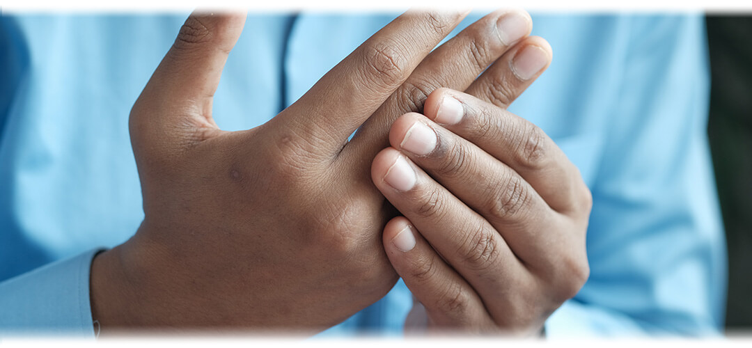 Close-up of hands with arthritis pain, symbolising the importance of managing symptoms through diet and avoiding trigger foods