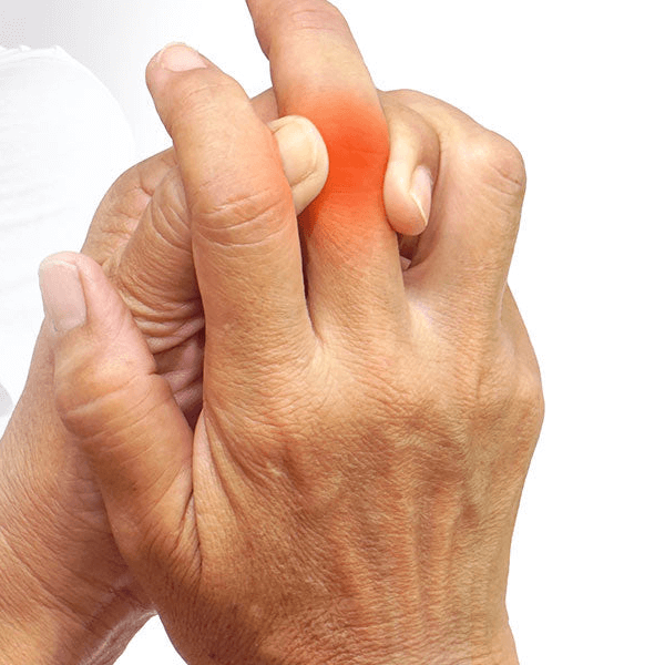 Close-up of hands with a red area on the knuckle indicating pain or inflammation